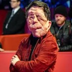 A person who has a facial difference, the actor Adam Pearson. He has visible neurofibromatosis. He is dressed in a red jacket and has his arms crossed. The background is a blurred public setting, likely an event or gathering, with other attendees visible in casual and formal attire.